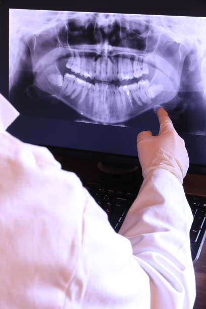 Best Emergency Dental Care for Broken or Chipped Teeth in Goodlettsville, TN
