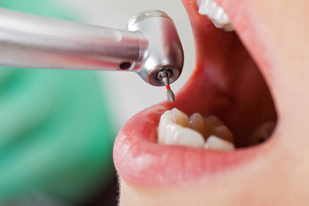 Best Pediatric Emergency Dentist in Goodlettsville, TN